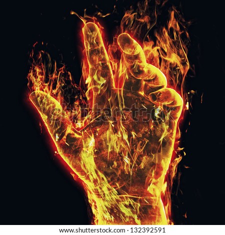 Burn Hand Stock Photos, Images, & Pictures 