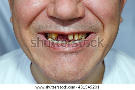 Toothless Stock Images, Royalty-Free Images & Vectors | Shutterstock