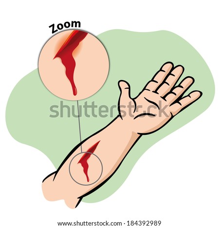 First Aid wound with blood - stock vector