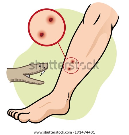 Half Man Half Biscuit Back In The DHSS Half Man Half Biscuit Back In The DHSS