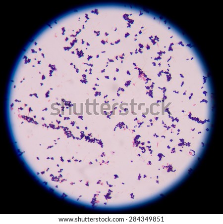 Cocci Stock Photos, Royalty-free Images & Vectors - Shutterstock