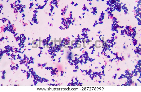 gram staining method called bacterial shutterstock differentiating positive negative grams species into flagellation groups