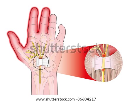 Join. happens. Compressed facial nerve Suggest Compressed facial nerve opinion obvious