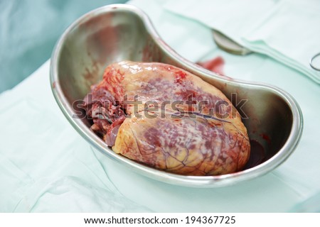 Viagra use before surgery
