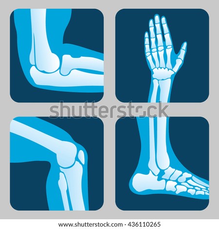 Human joints, knee joint, elbow joint, ankle joint, wrist. Medical orthopedic vector of set. Anatomy orthopedic human joint and illustration icon leg and hand joint - stock vector Human joints, knee joint, elbow joint, ankle joint, wrist. Medical orthopedic vector of set. Anatomy orthopedic human joint and illustration icon leg and hand joint - stock vector