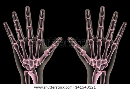 Xray Hands Showing Middle Finger Stock Illustration 141962452