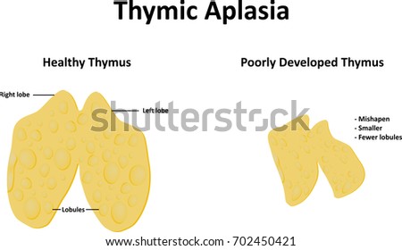 Thymus Structure Vector Diagram Gland Lies Stock Vector 186324788