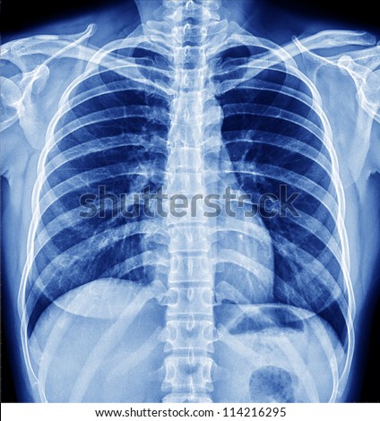 Xray Stock Images Royalty Free Images Vectors Shutterstock