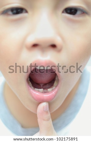 Close up first tooth after loss milk tooth asian boy. - stock photo - stock-photo-close-up-first-tooth-after-loss-milk-tooth-asian-boy-102175891