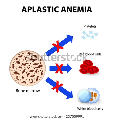 Pancytopenia - Cat