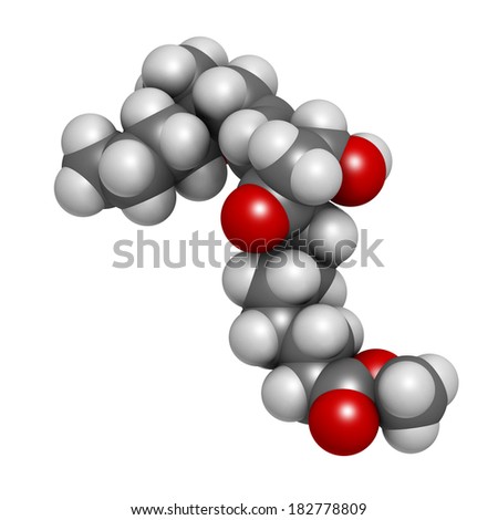 misoprostol for missed miscarriage