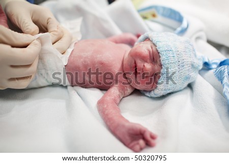 Newborn Baby Boy Covered Vernix Incubator Stock Photo 80183833 ...