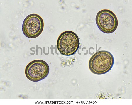 Pinworm Stock Images, Royalty-Free Images & Vectors | Shutterstock