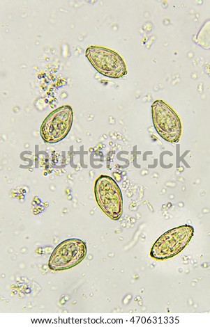 Liver Fluke Stock Images, Royalty-Free Images & Vectors | Shutterstock