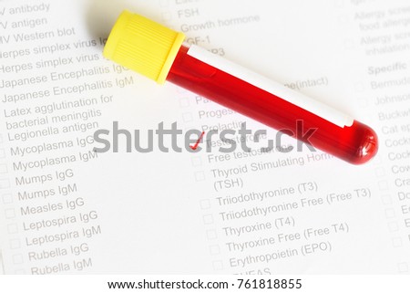Estradiol Blood Testing