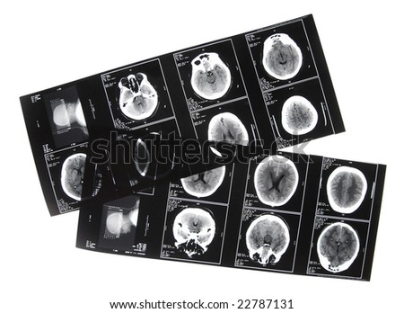 Brain Front Human View Stock Photos, Images, & Pictures | Shutterstock