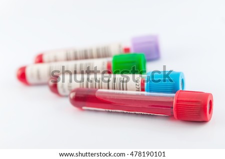 Test Tubes Collecting Medical Laboratory Stock Photo (Royalty Free ...