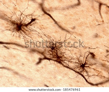 Astrocyte Stock Images, Royalty-Free Images & Vectors | Shutterstock