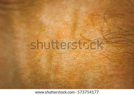 goose bumps on human skin closeup stock photo 556019386 goose bumps on human skin closeup stock photo 573754177 goose bumps on human skin closeup stock photo 556019386 goose bumps on human skin closeup stock photo 573754177