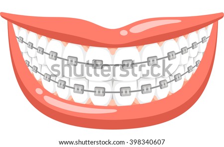 Big Smile Dental Braces Vector Cartoon 스톡 벡터 398340607 - Shutterstock