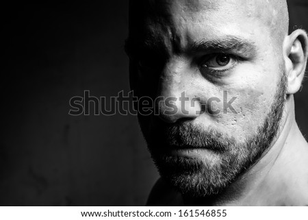 Man With Black Eye Stock Photos, Images, & Pictures | Shutterstock