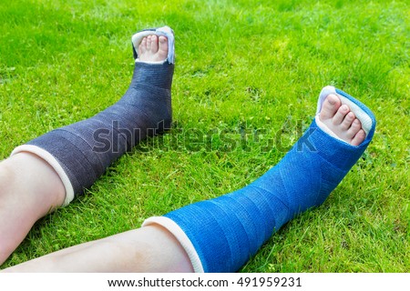 Leg Cast Stock Images Royalty Free Images Vectors 