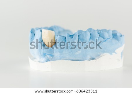 Gypsum Model  Artificial Teeth Dental Technician Stock 