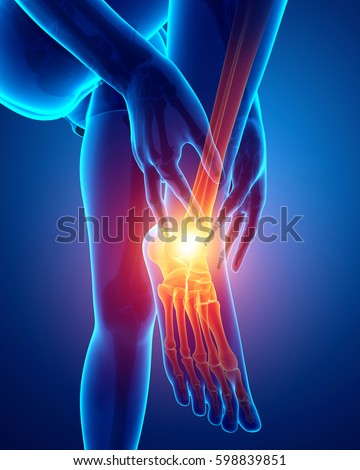 3d Illustration Men Joint Pain Stock Illustration 603101948 - Shutterstock