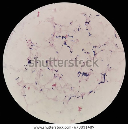 Gram Positive Cocci Blood Culture