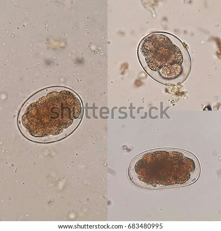 Hookworm Stock Images, Royalty-Free Images & Vectors | Shutterstock