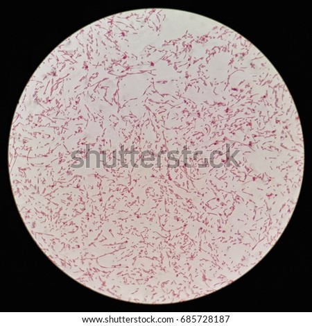 Smear Gram Negative Bacilli Bacteria Under Stock Photo ...