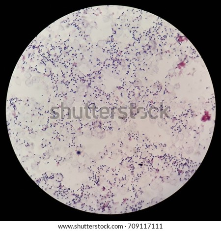 Smear Human Blood Cultured Grams Stained Stock Photo 709117111 ...