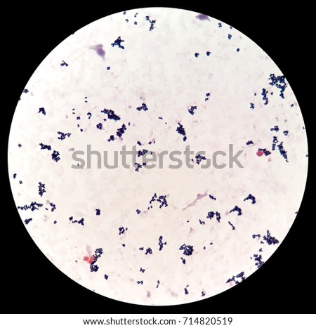 Gram Positive Cocci Blood Culture