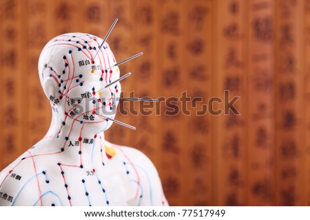 Eastern or Asian acupuncture Medical Treatment.