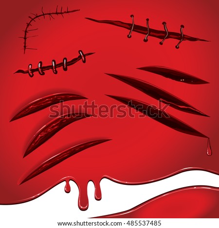skin scar stock images royalty free images vectors scars stock images royalty free images vectors skin scar stock images royalty free images vectors scars stock images royalty free images vectors