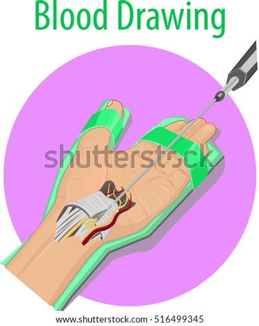 Vector Illustration Arm Anatomy Stock Vector 516499321 - Shutterstock