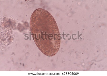 Liver Fluke Stock Images, Royalty-Free Images & Vectors | Shutterstock