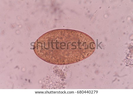 Liver Fluke Stock Images, Royalty-Free Images & Vectors | Shutterstock