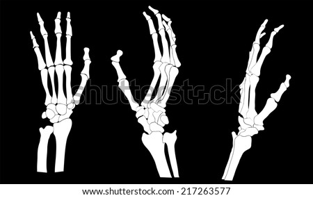 Set Skeleton Hands Vector Illustration Stock Vector (Royalty Free