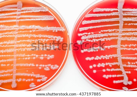 Bacterial Culture Stock Photos, Royalty-Free Images & Vectors ...