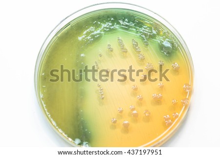 Bacterial Culture Growth On Chocolate Agargram Stock Photo 437197951 ...