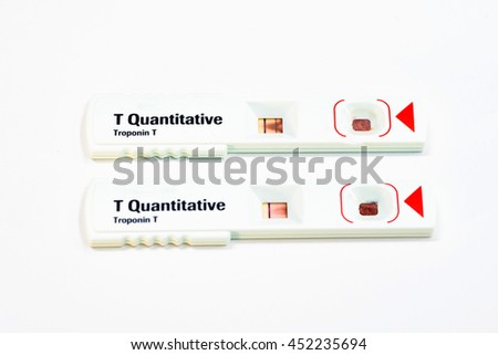 test attack t heart for T Positive Stock Negative Test Compare Photo Troponin