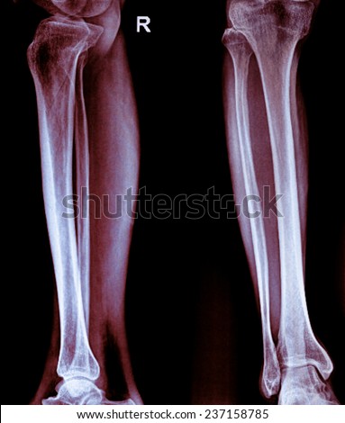 Human Body Bone Joint Pains Foot Stock Illustration 450939025