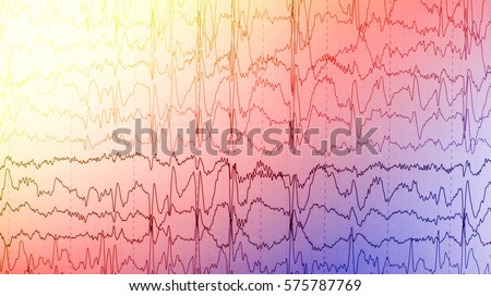 test heart eeg Rhythm Heart Photo Chart Background Stock Usage 438428002