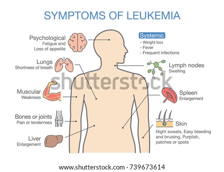 Common Symptoms Signs Leukemia Medical Illustration Stock ... lymphoma cancer diagrams 