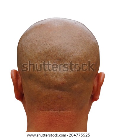 Bald Head Man Stock Images, Royalty-Free Images & Vectors | Shutterstock