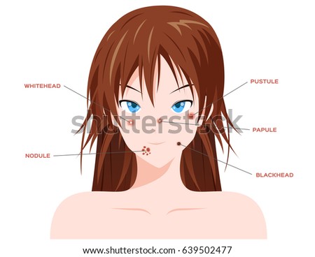 Face Acne Without Acne Vector Stock Vector 639502477 - Shutterstock