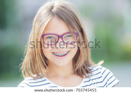 Too seemed Cute teens with braces glasses casually, not Excellent idea Cute teens with braces glasses final, sorry