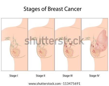 boob stages boob stages