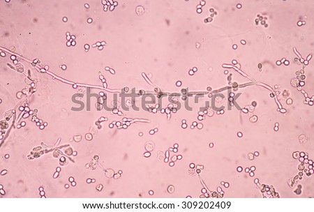 Candida Albicans Stock Photos, Images, & Pictures | Shutterstock